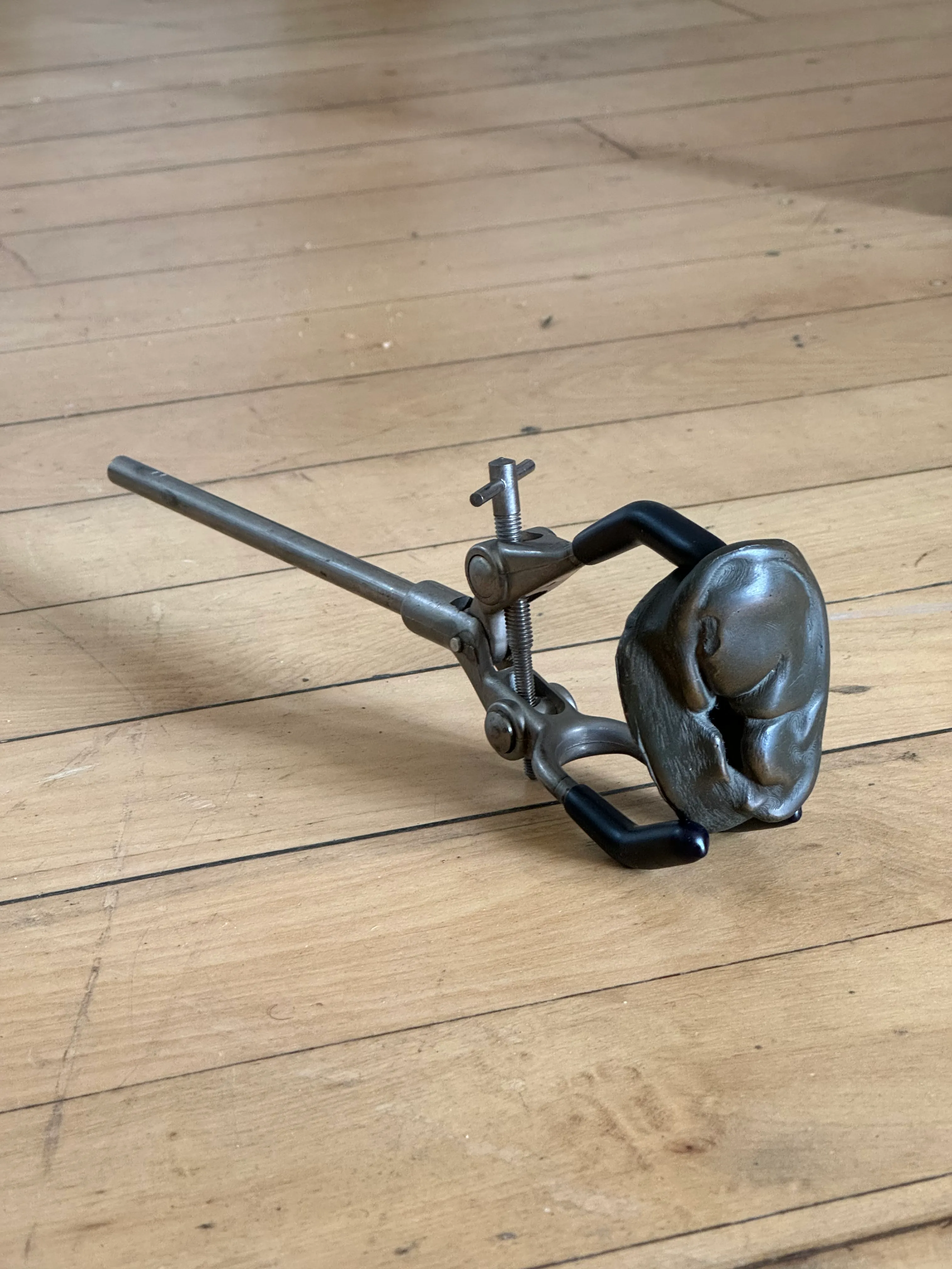 For What Accumulates Within You Like Rocks